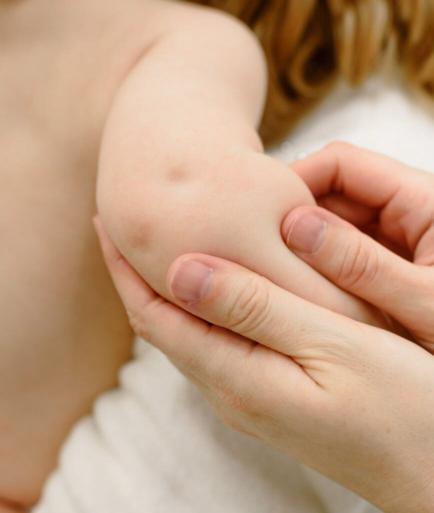 A nursemaid's elbow occurs when the radius (a bone in the forearm) slips from where it normally attaches to the elbow joint.